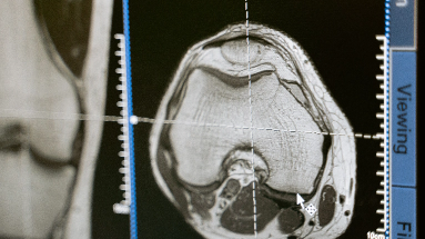 MRI scan